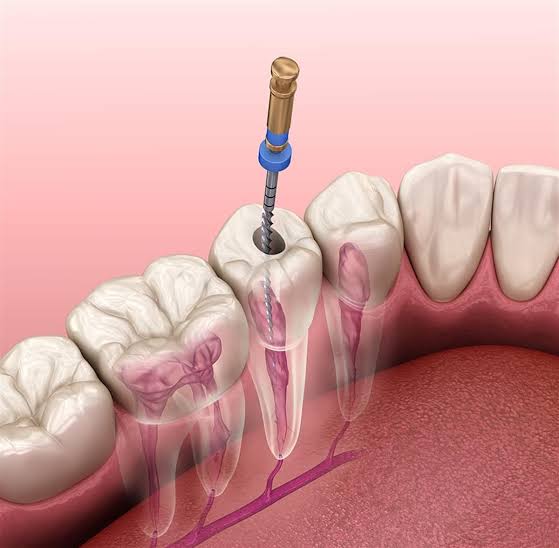 Endodonti
